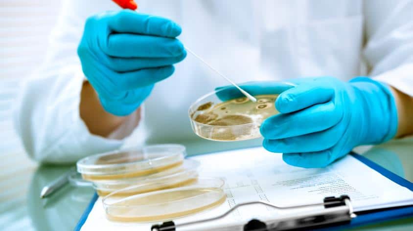 listeria bacteria in lab test tray